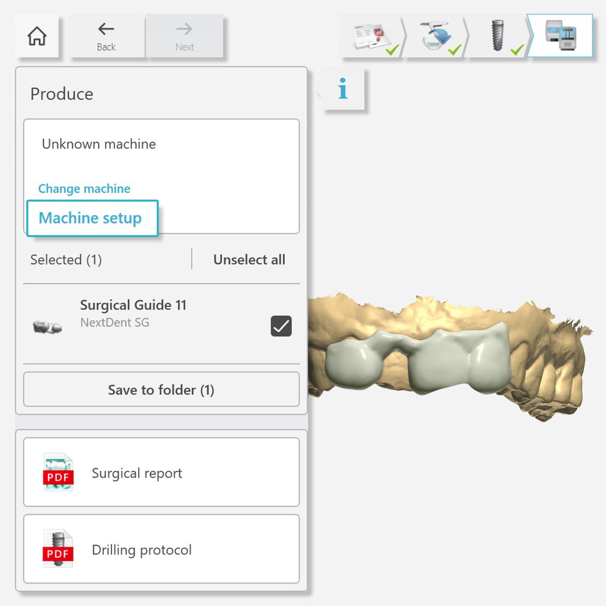 3shape Positioning Guide.pdf Integrate 3Shape Produce with Phrozen DS Slicer | Step-by-Step Guide